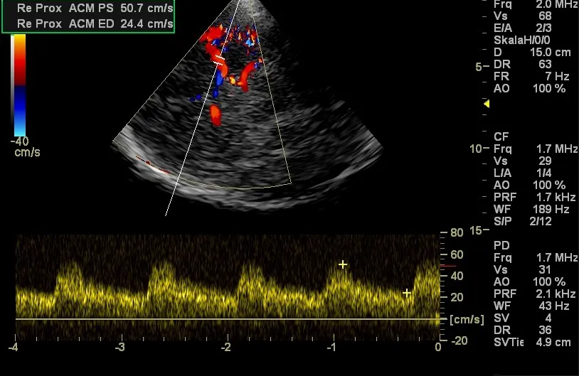 Transkranielle Doppler- und Duplexsonografie in der Praxis Dr. Sirkis, Eschborn
